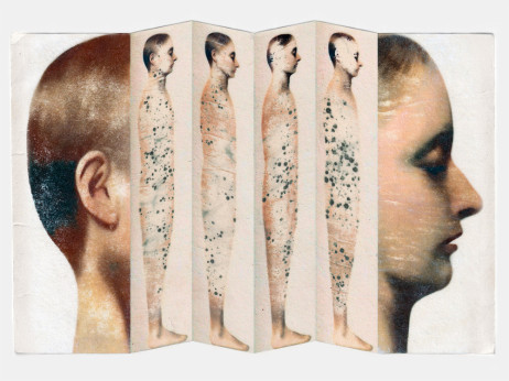 Kako covid tiho preobrazi možgane